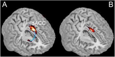 Long-Term Physical Exercise and Mindfulness Practice in an Aging Population